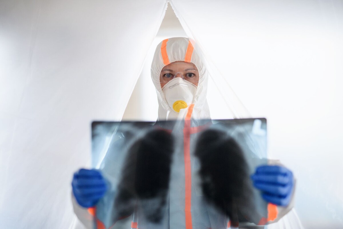 doctor with protective suit and lungs x ray in hos vxu