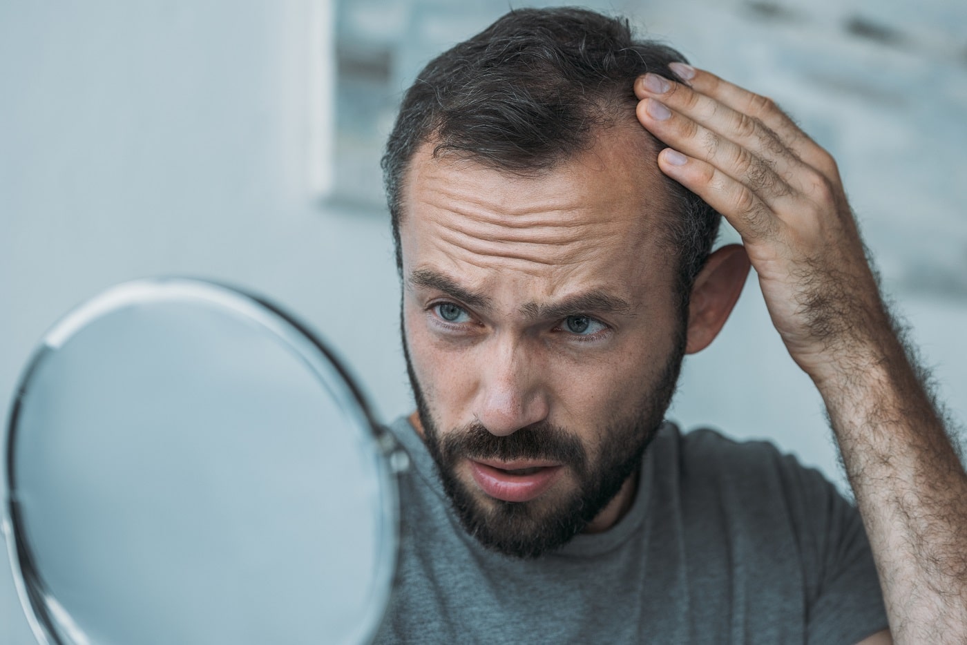 upset middle aged man with alopecia looking at mirror min